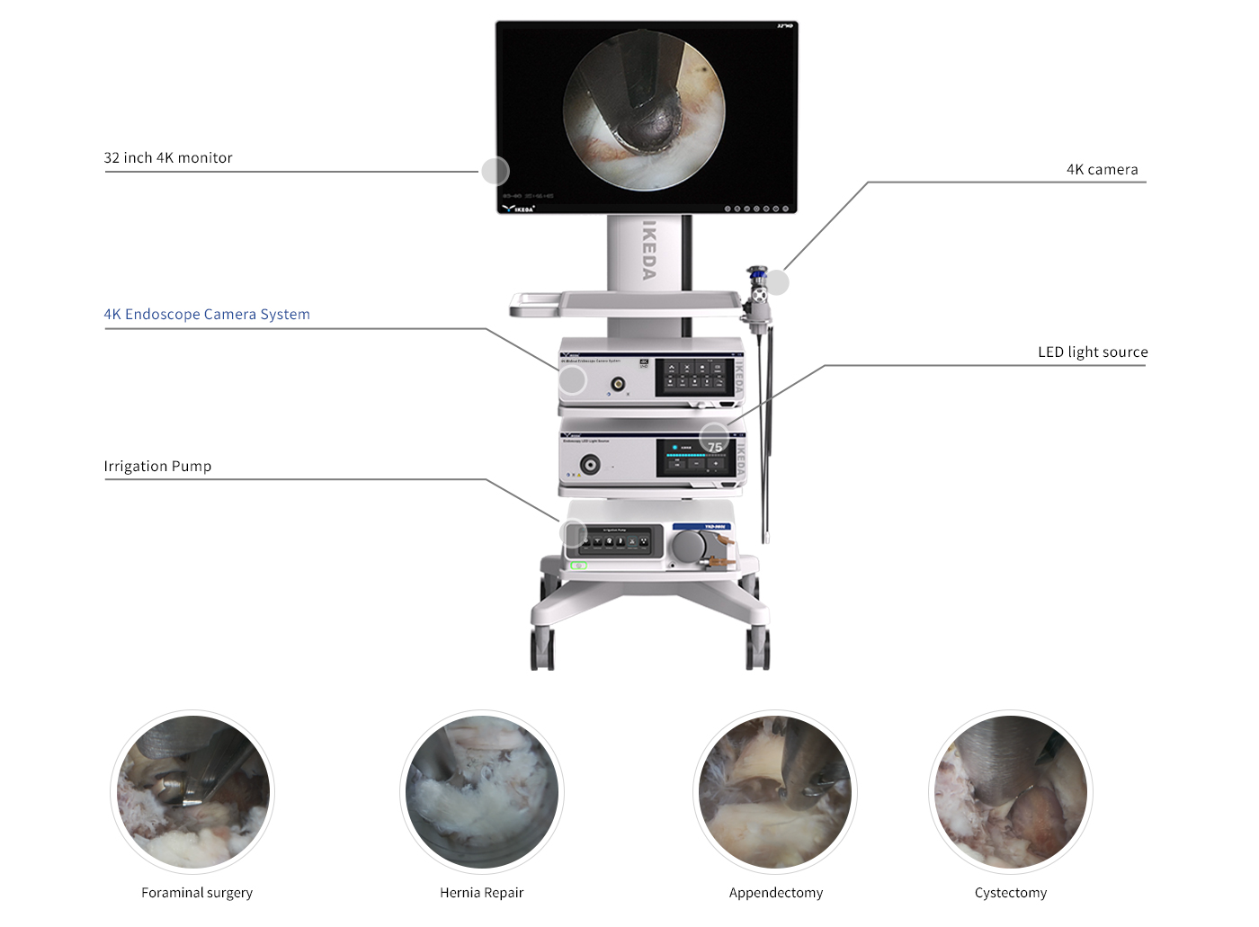 4K-Arthroscopy_79103