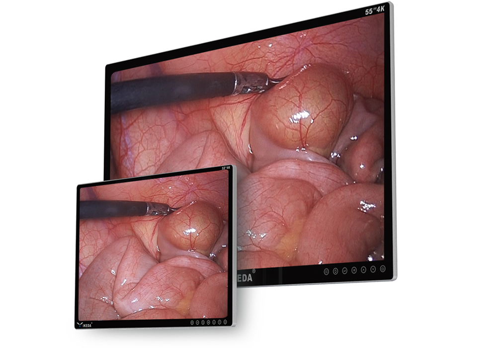 شاشة طبية بدقة 4K