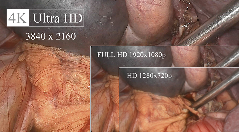 4K Ultra HD definition-