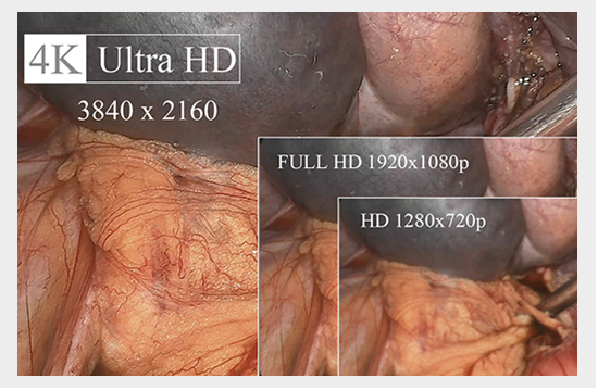 4K Ultra HD-Definition