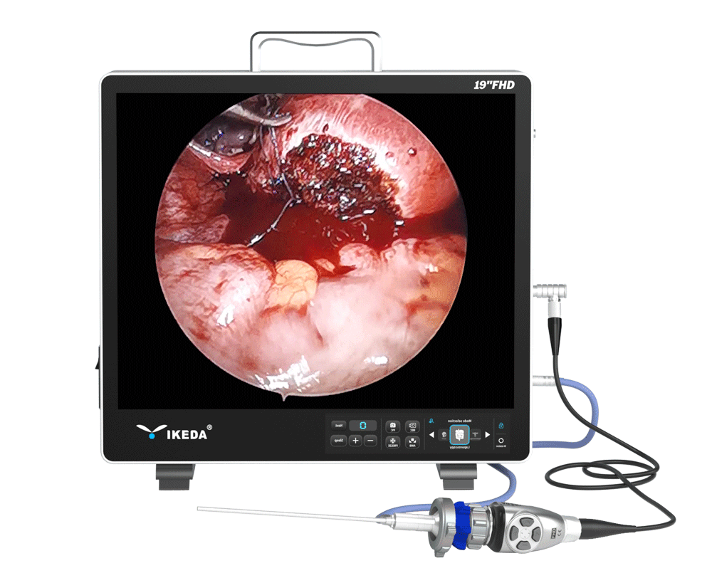 Système de caméra endoscopique médicale portable
