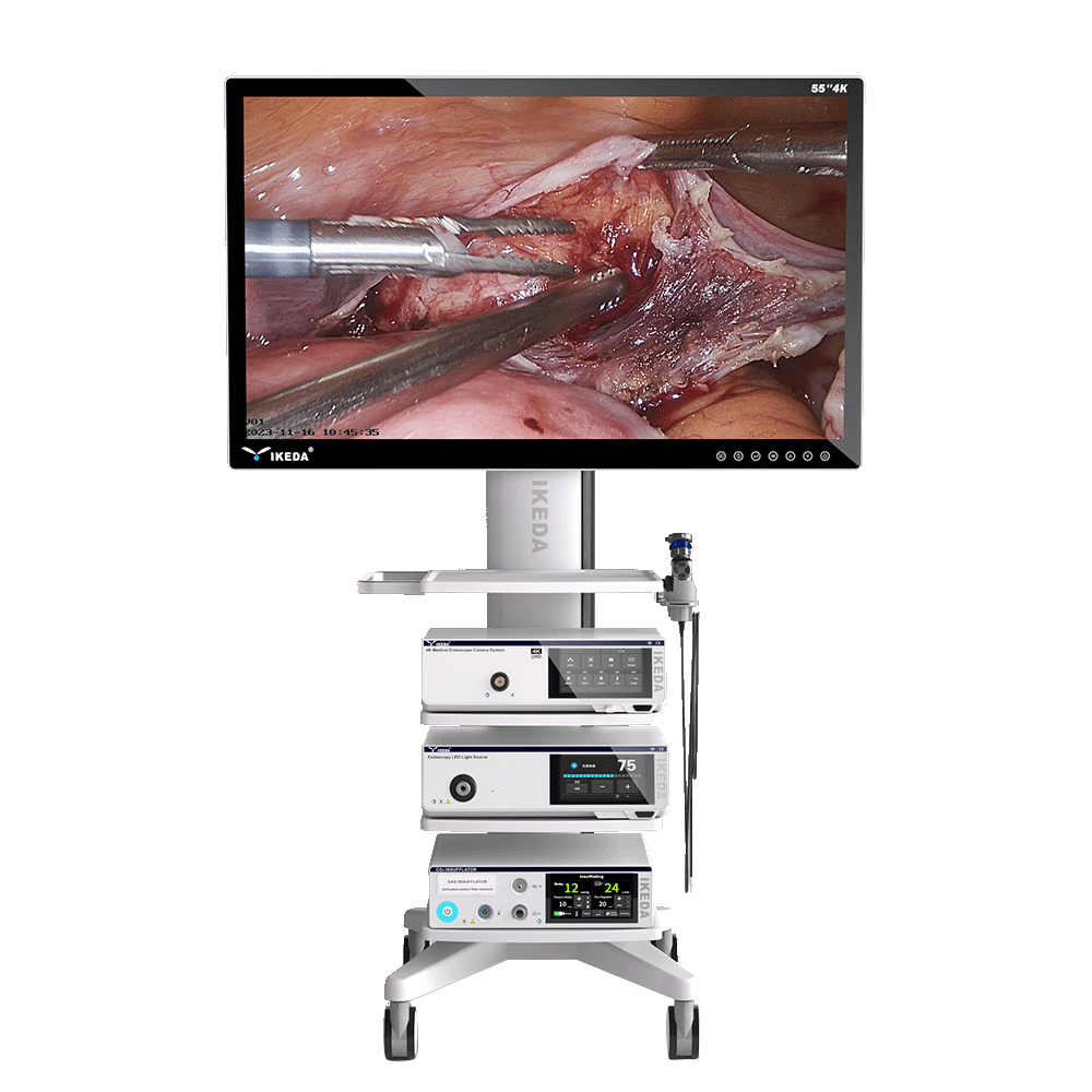 9211_4K_Endoscopy_73015