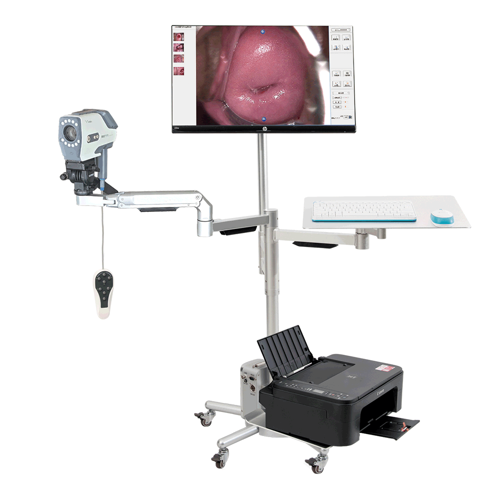 Digital Colposcope