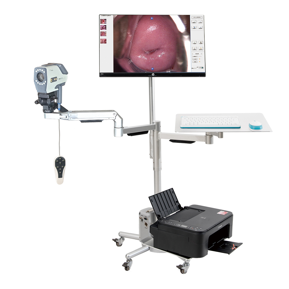 Digital Colposcope