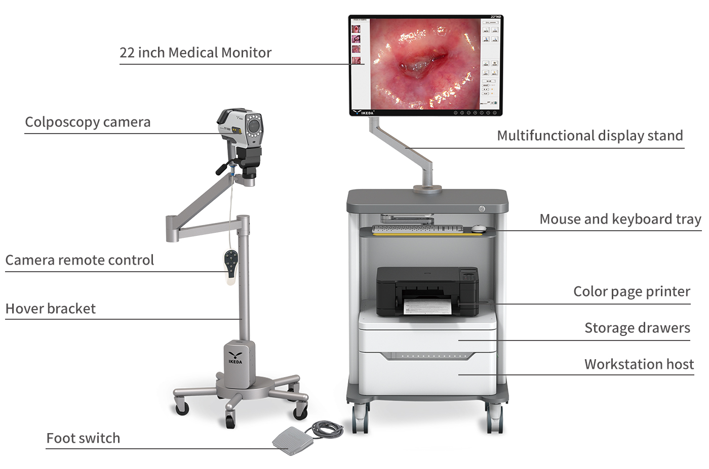 Digital Video Colposcope