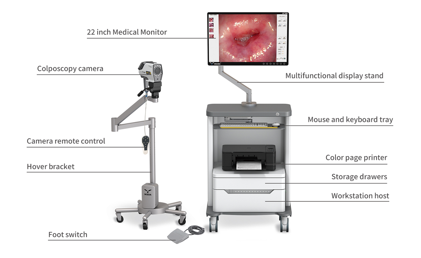 Digital Video Colposcope