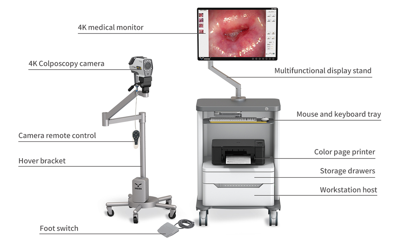 4K Digital Video Colposcope