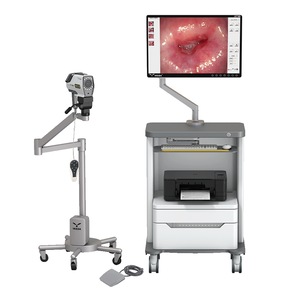 Digital-Video-Colposcope