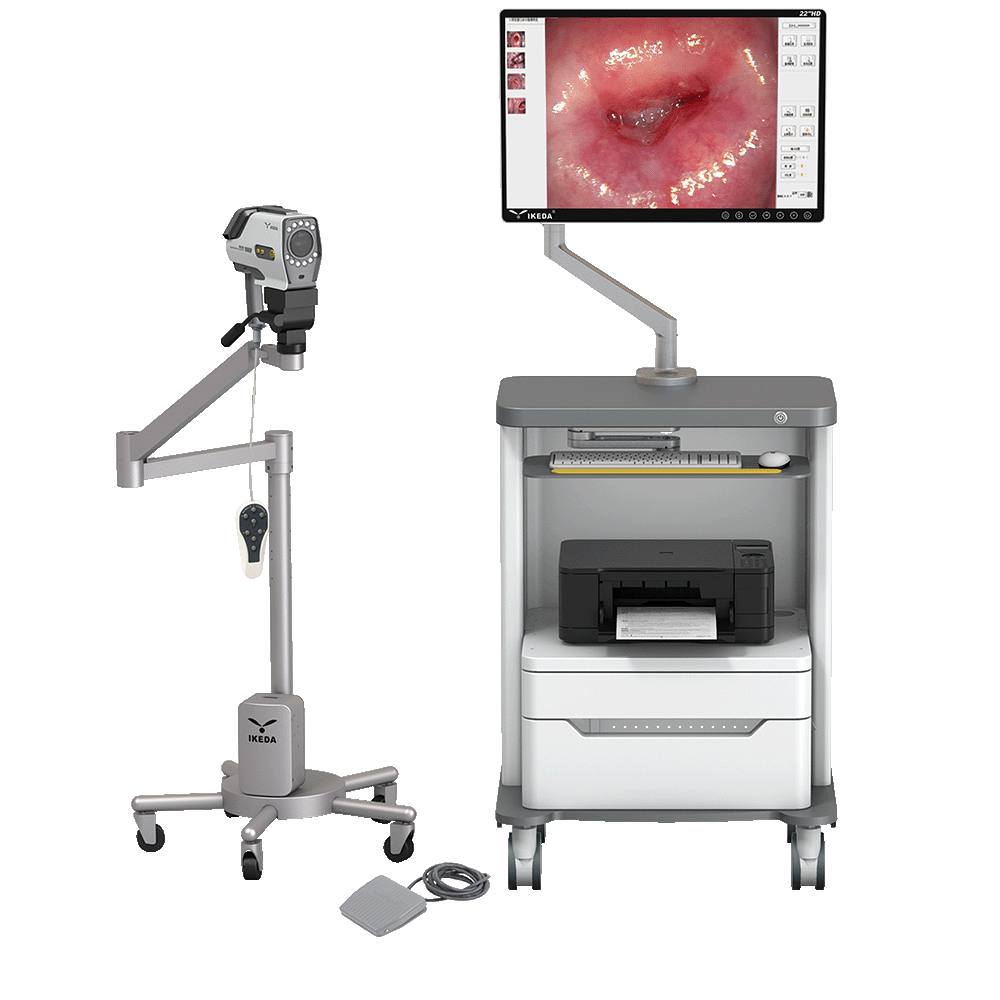 Digital Video Colposcope