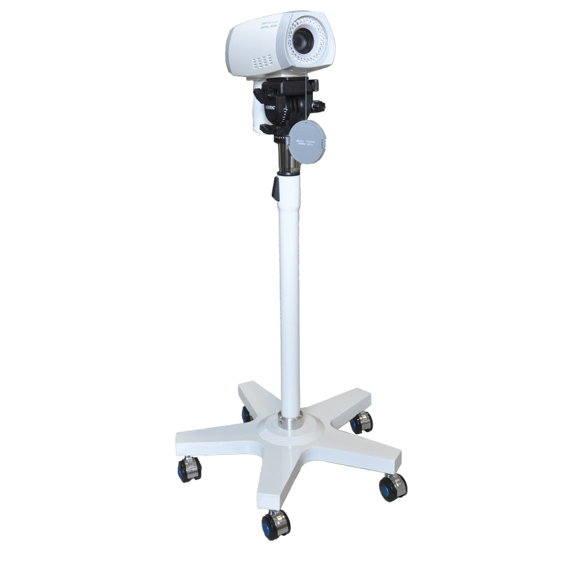 Digital Video Colposcope