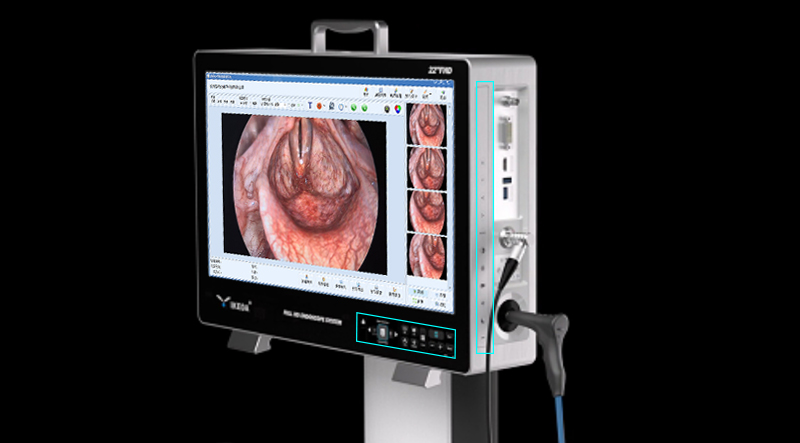 Dual-operation Control System(Touch Screen+Mechanical Bottons)