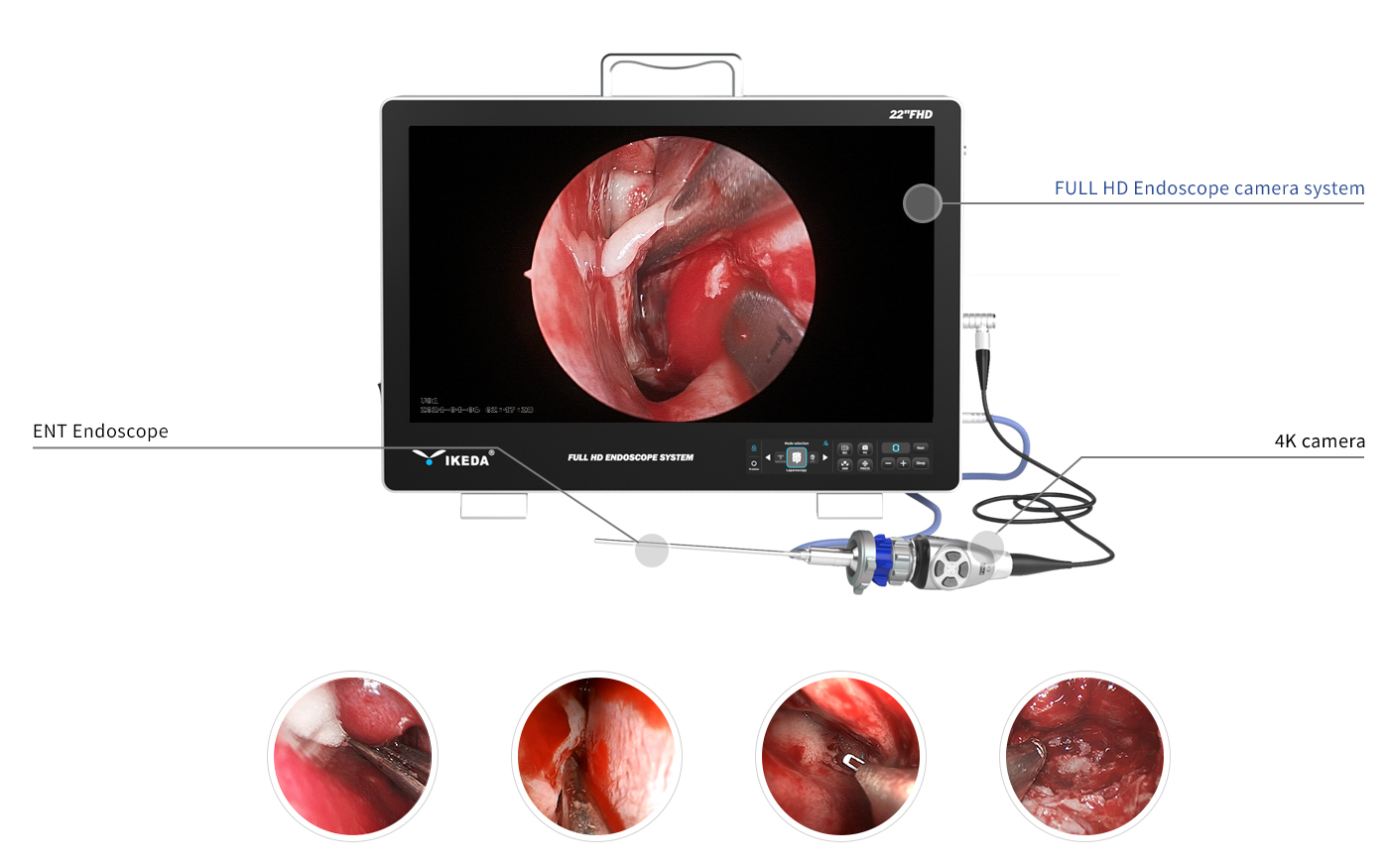Endoscope ORL