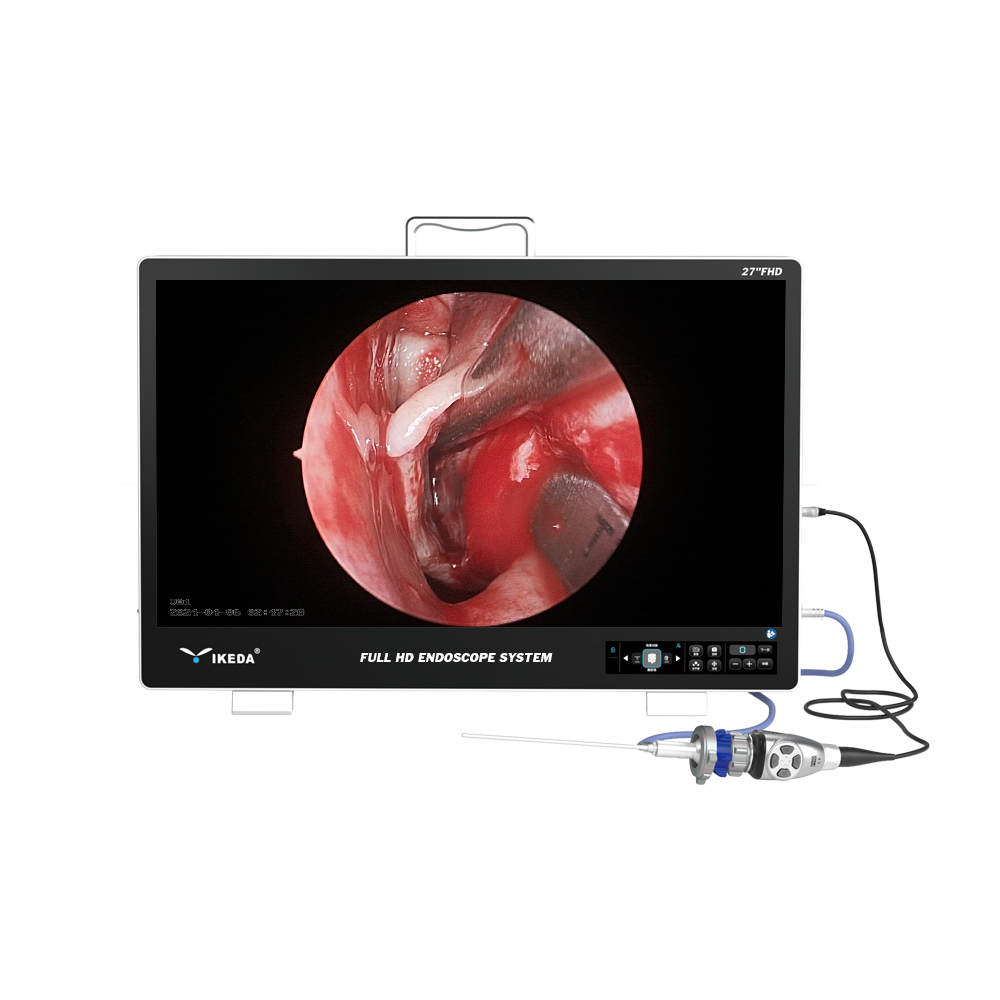 Sistema de endoscopia portátil