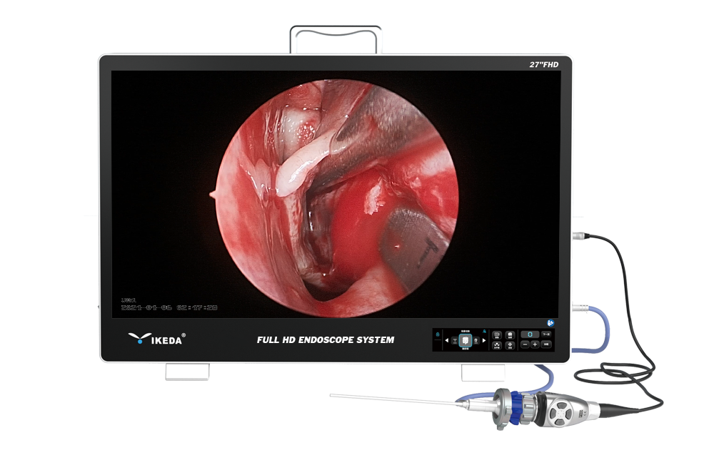 Système d'endoscopie portable