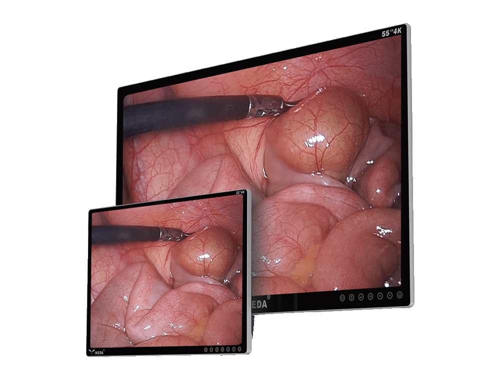 شاشة طبية بدقة 4K