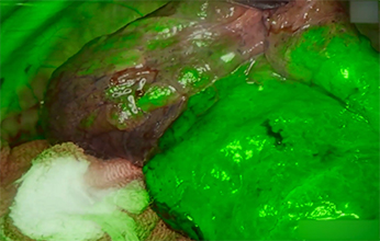 Modo de fluorescência