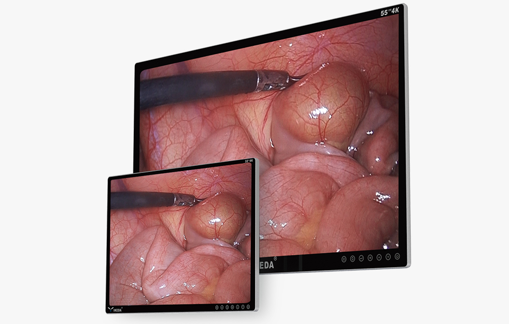 4K-Medizinmonitor