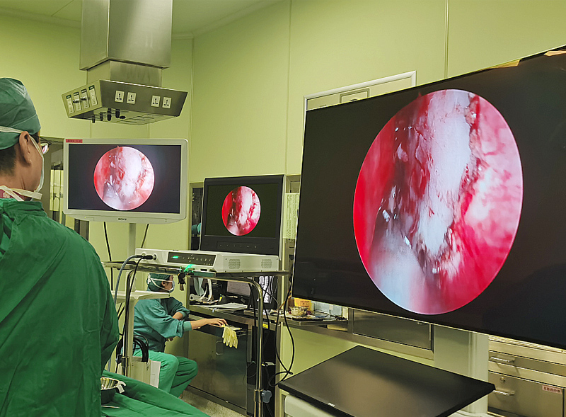 4K-Endoskop-Kamerasystem in der Neurochirurgie
