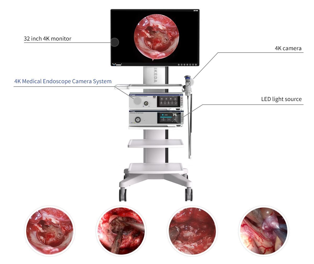 4K-Endoskop-Kamerasystem in der Neurochirurgie