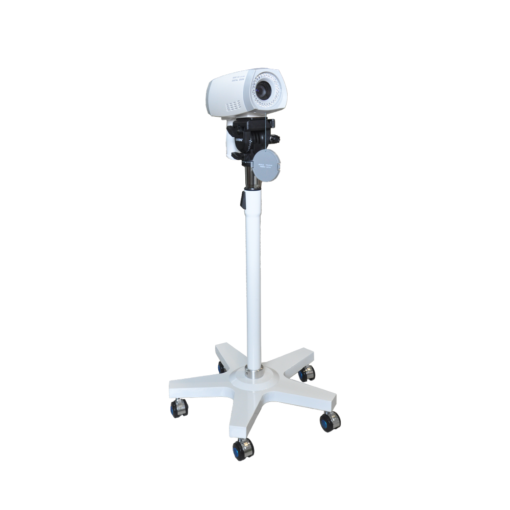 Digital Video Colposcope