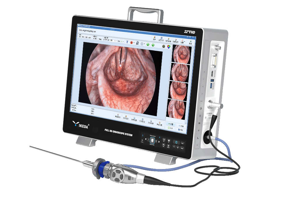 Portable-Endoscopy-camera