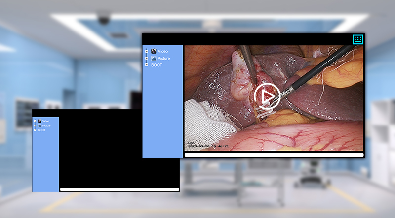 Surgical Video Recording and Playback