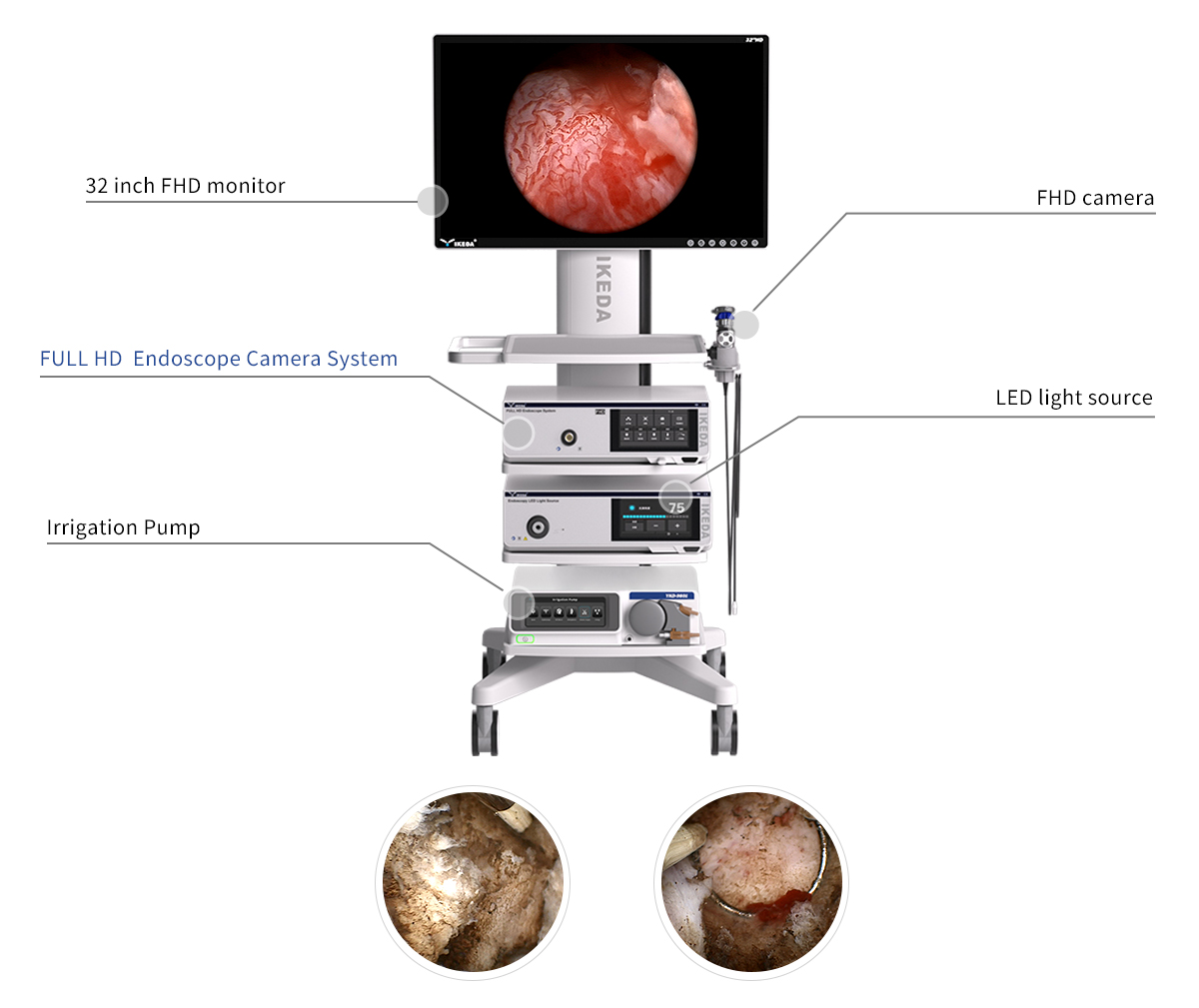 Solutions d'urologie