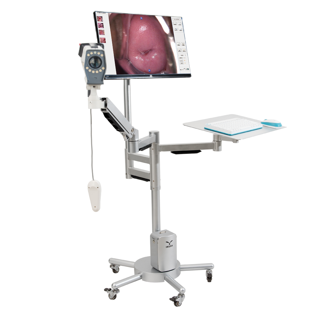 Digital Video Colposcope