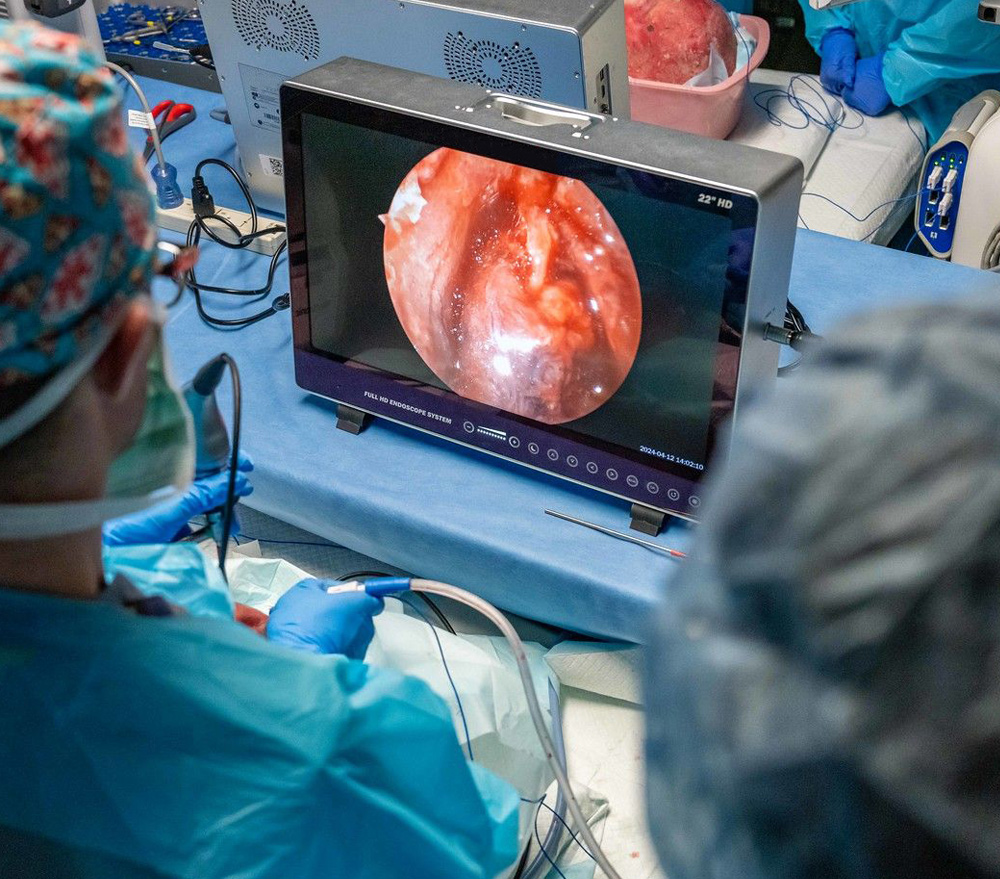 Portable ENT Endoscopy Unit