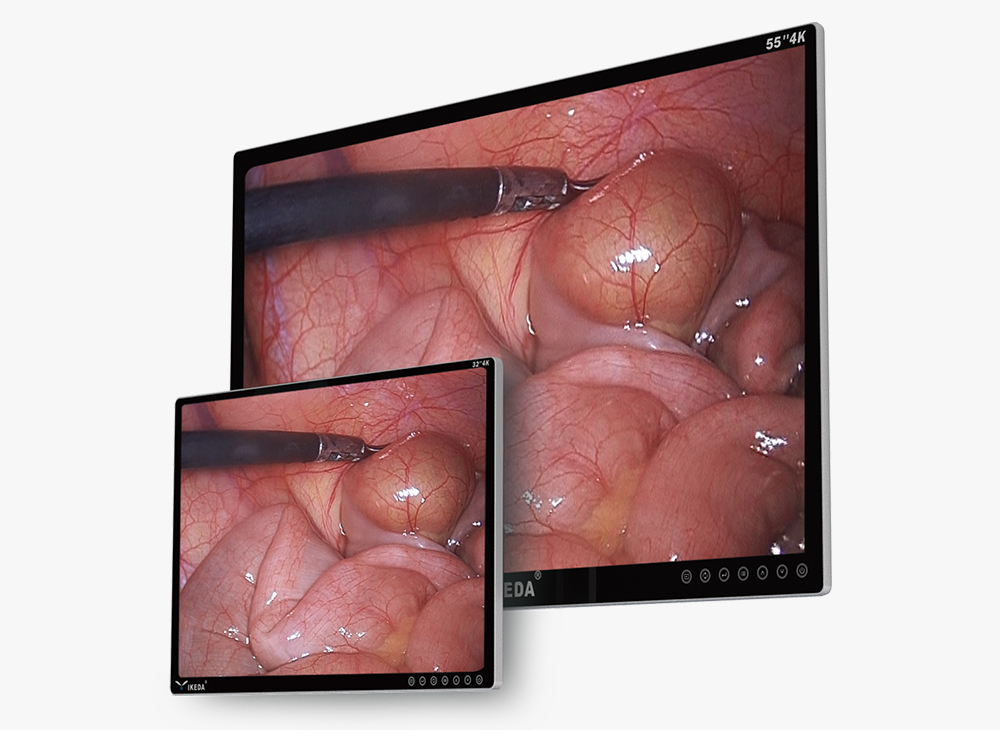 Sistema de endoscópio FULL HD