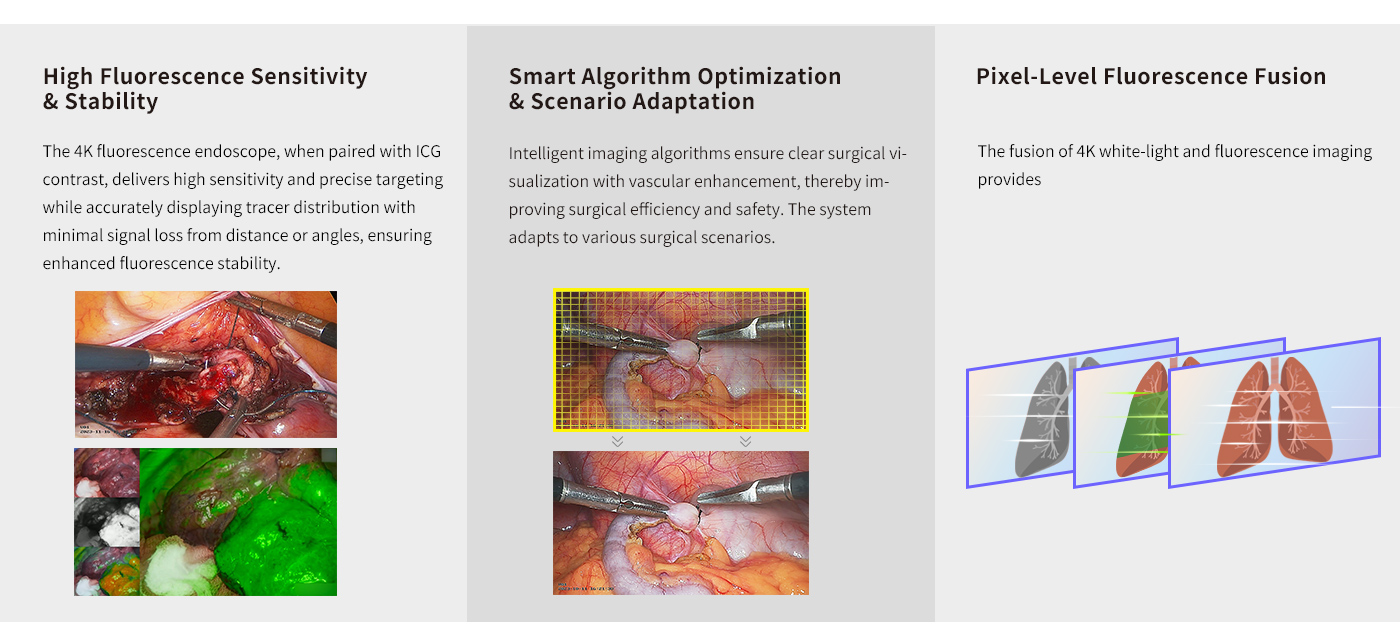 نظام كاميرا منظار الفلورسنت بدقة 4K