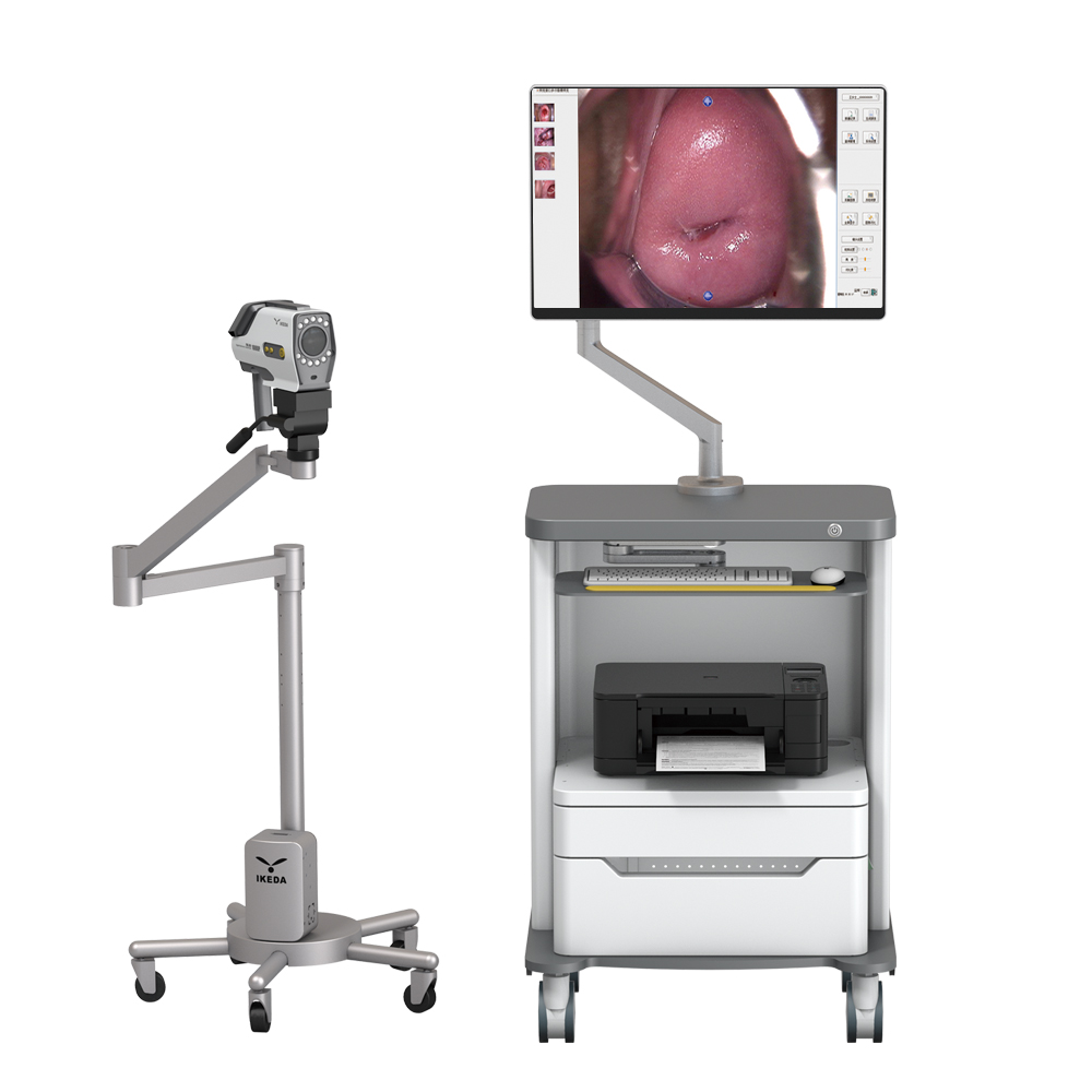 Digital Video Colposcope