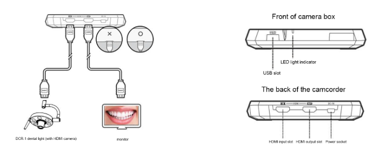 silla de implantes